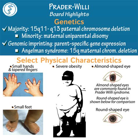 prada willis|prader willi syndrome prognosis.